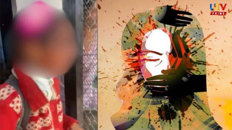 Acid attack on 13-year-old school girl… The person who came on a two-wheeler fled!