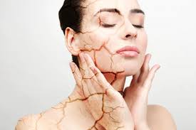 Signs Of Dehydration Summer Care Tips Tamil