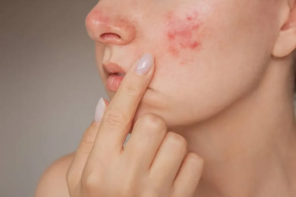 jasmine-flower-beauty-tips-skin-hair-care